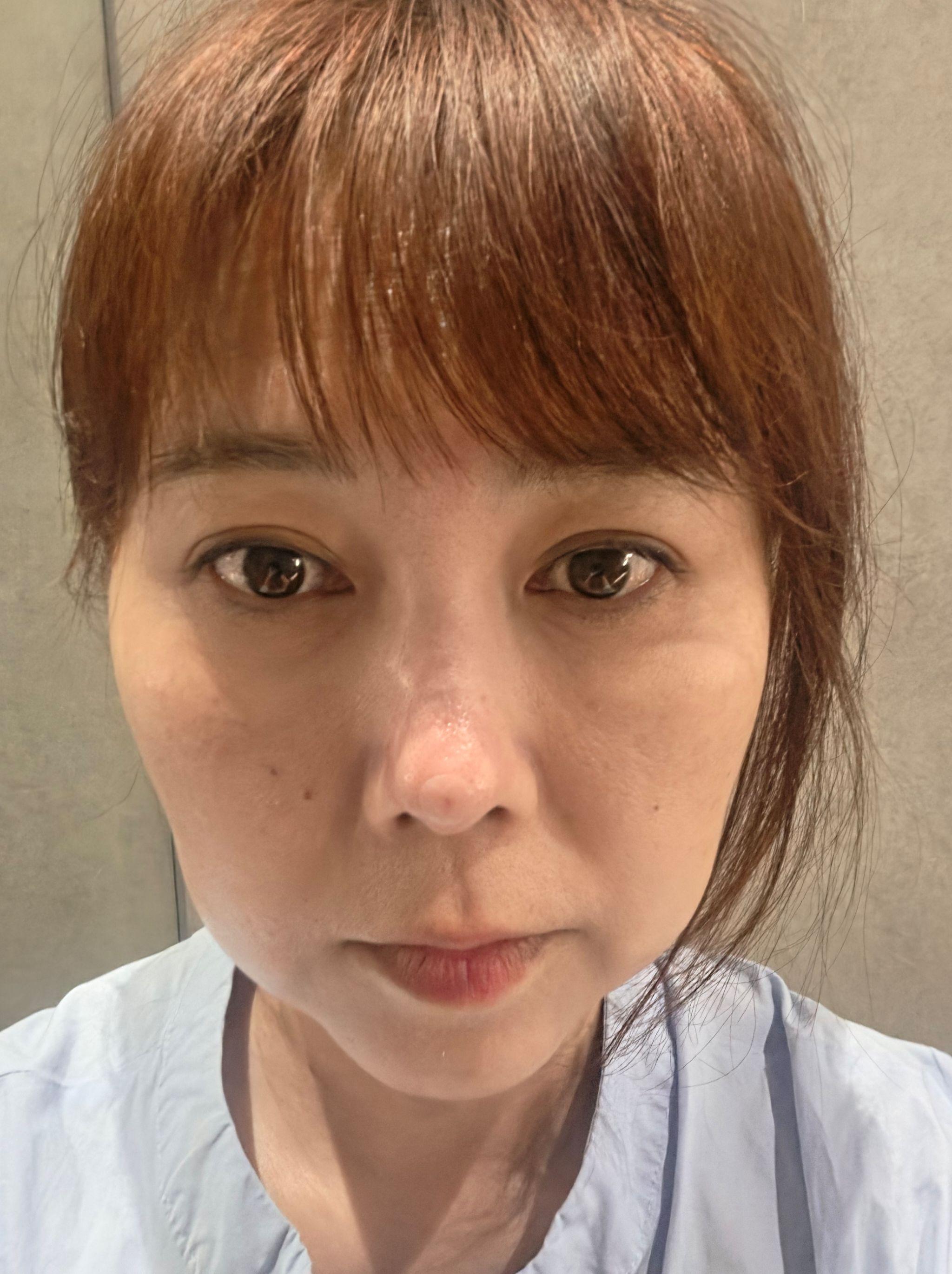 後
