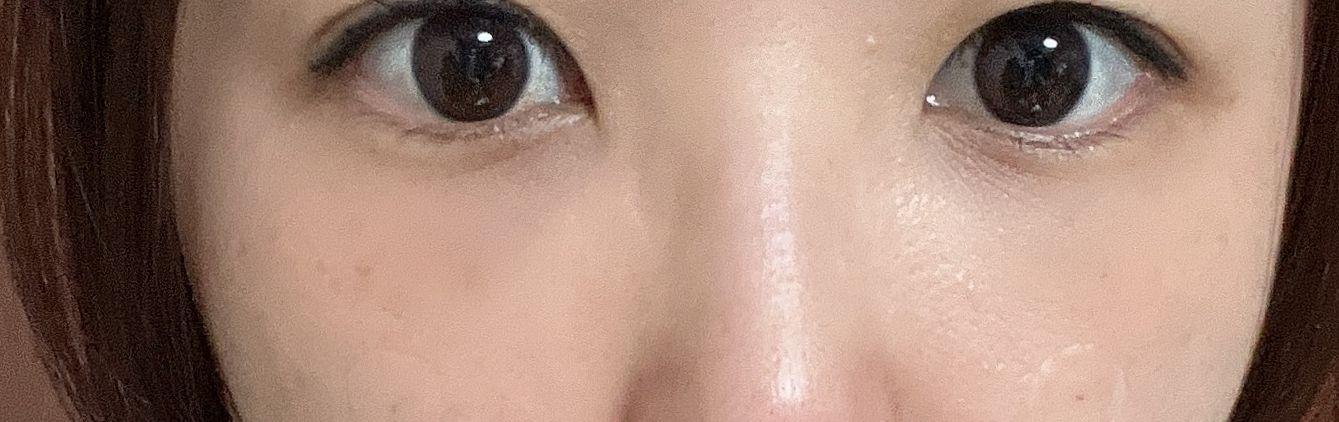 後