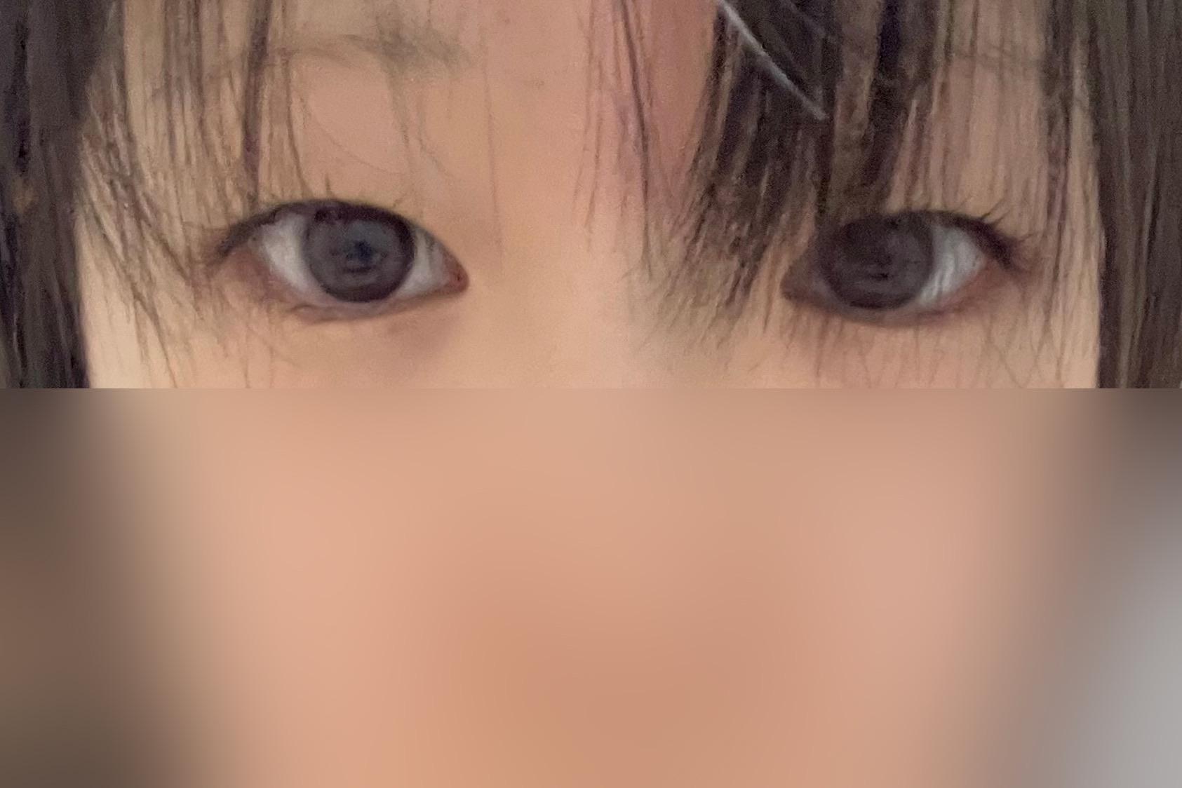 後