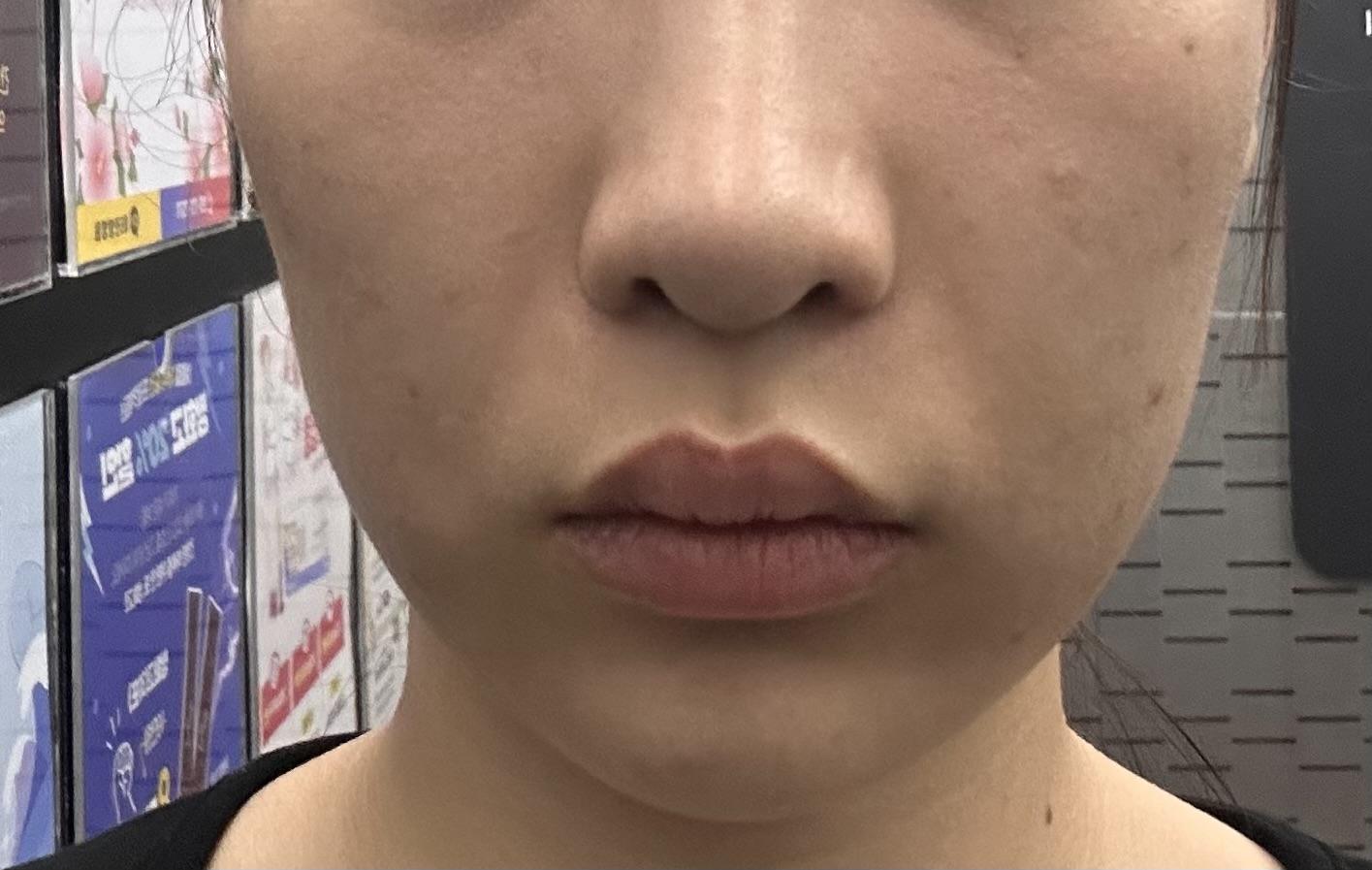 後