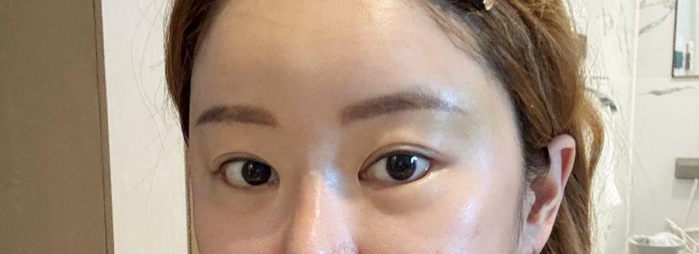後
