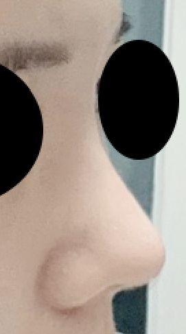 後