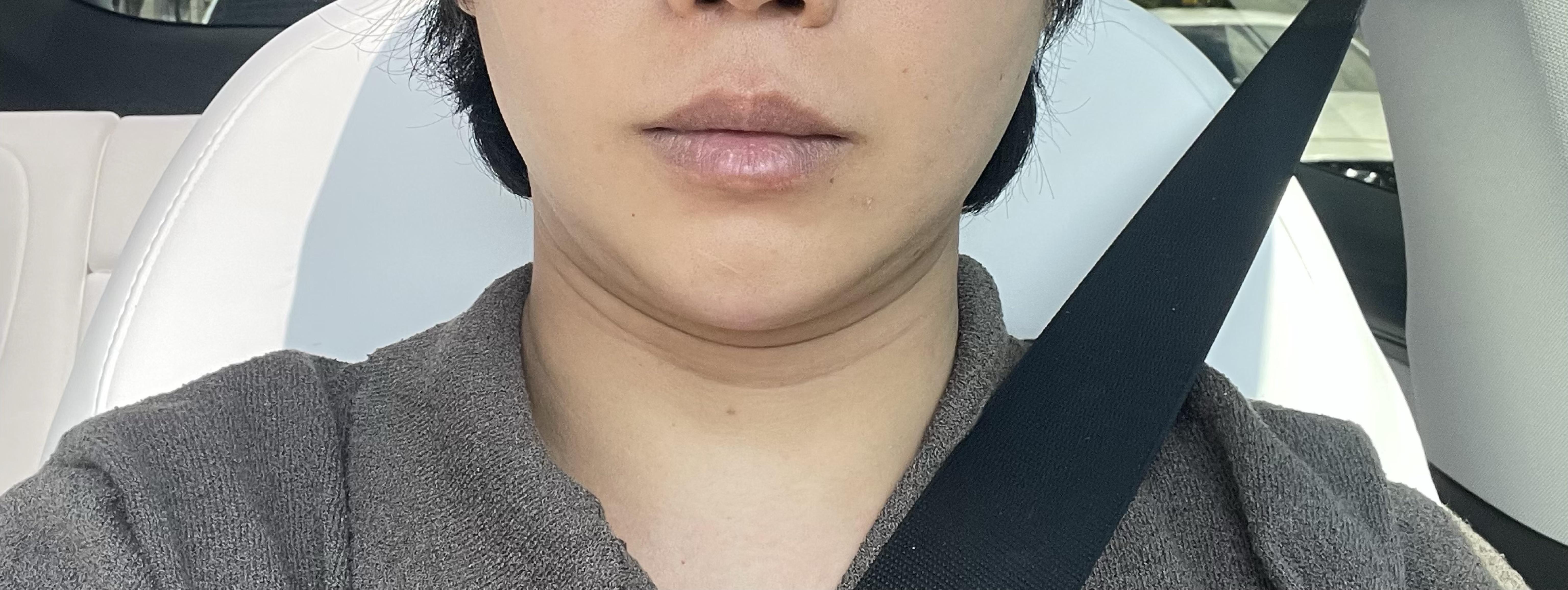 後