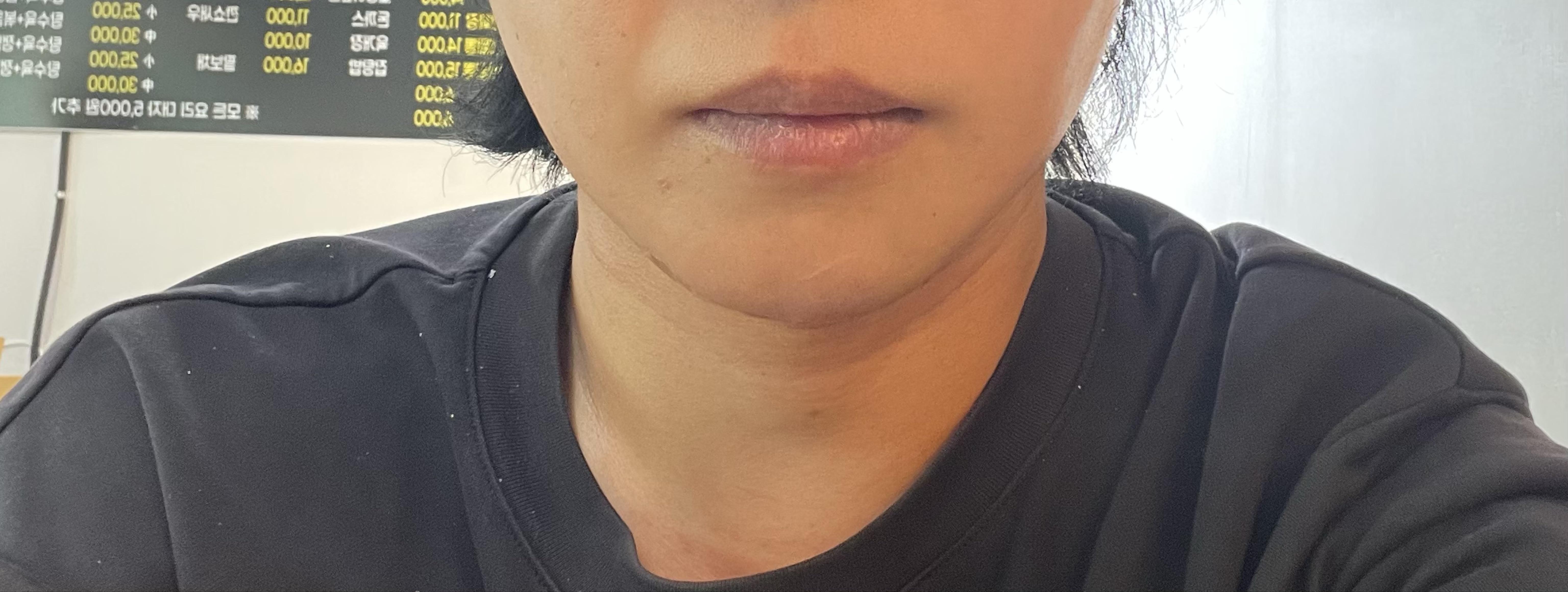後