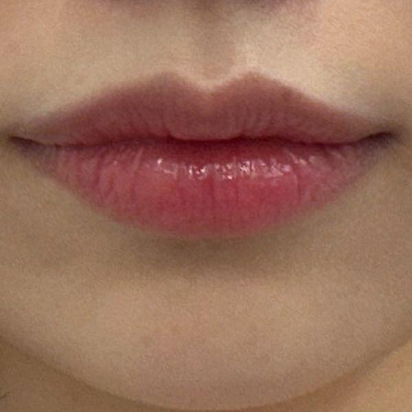 后