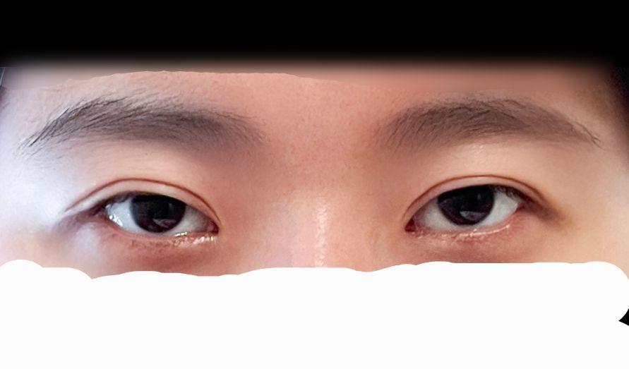 後