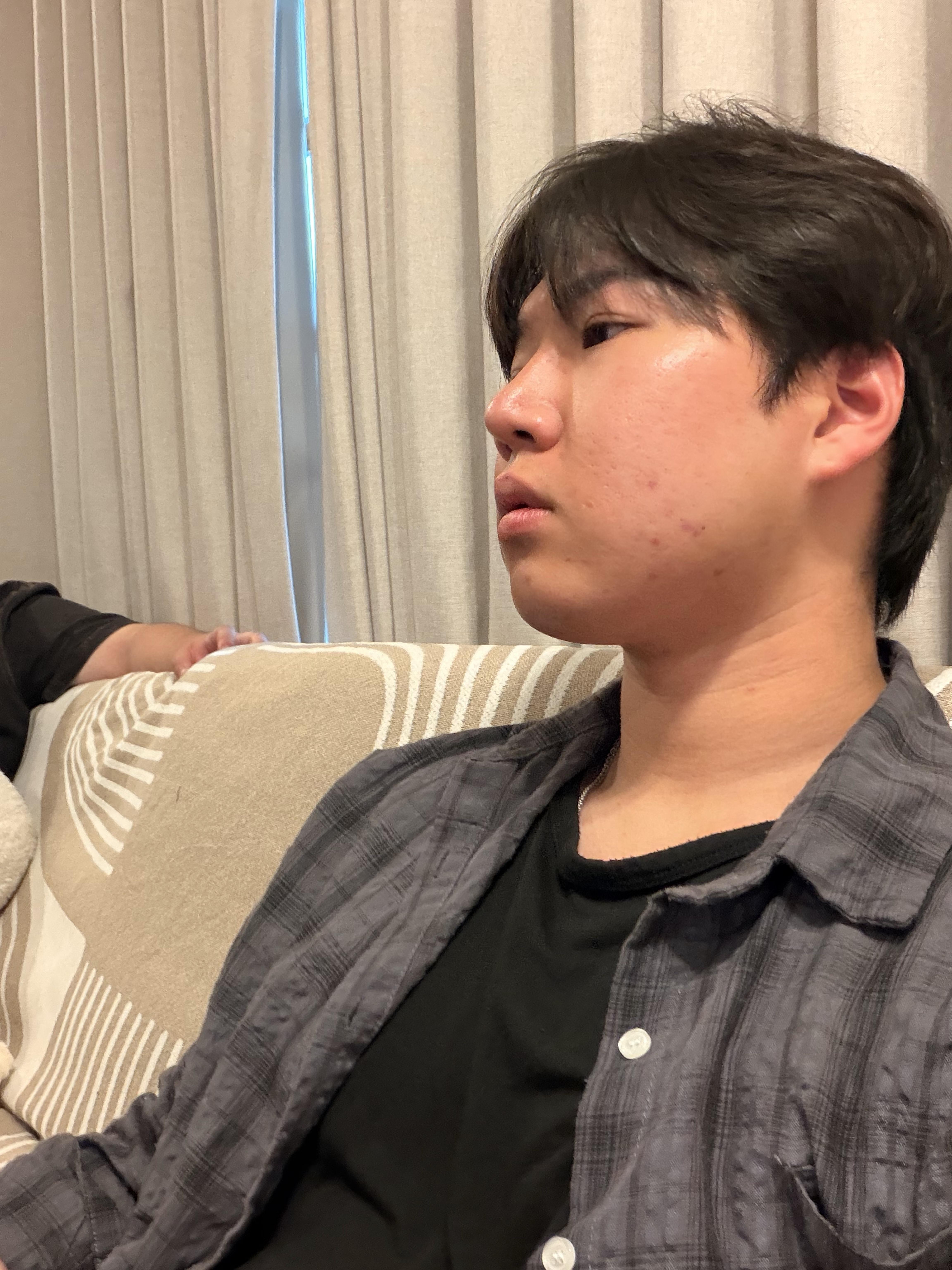 後