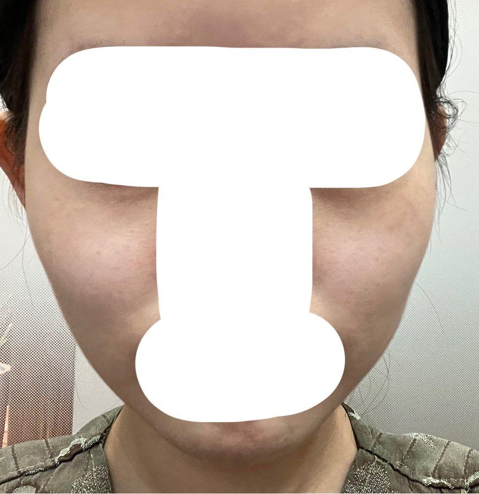 後
