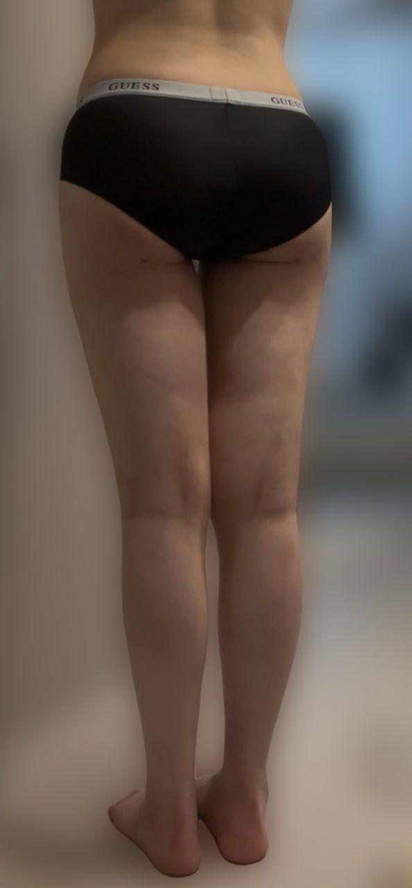 後
