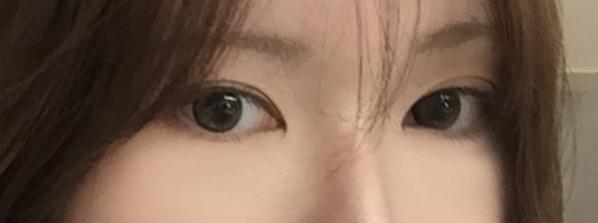 後