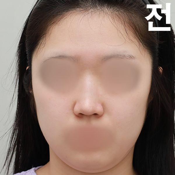 後