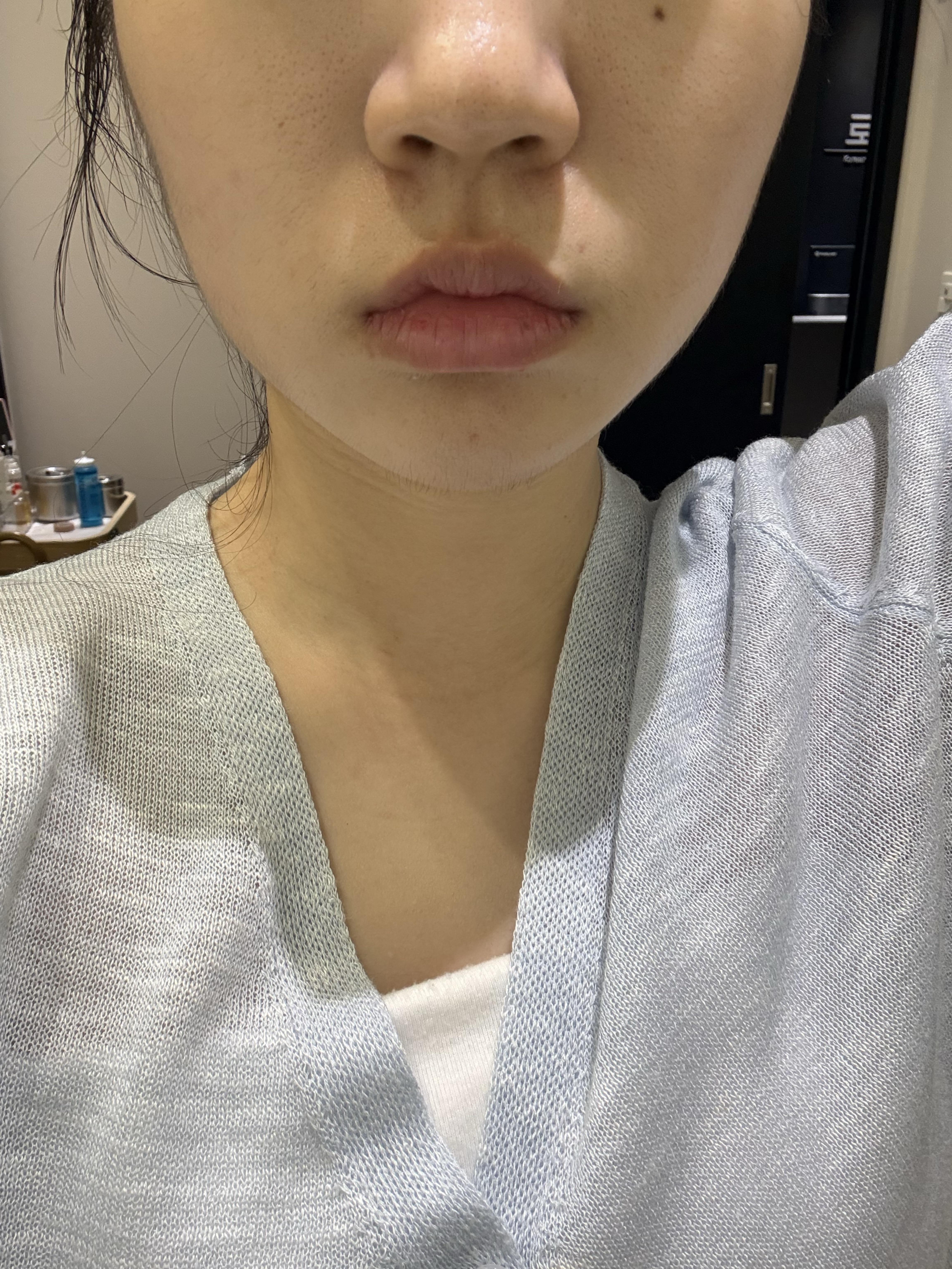 後