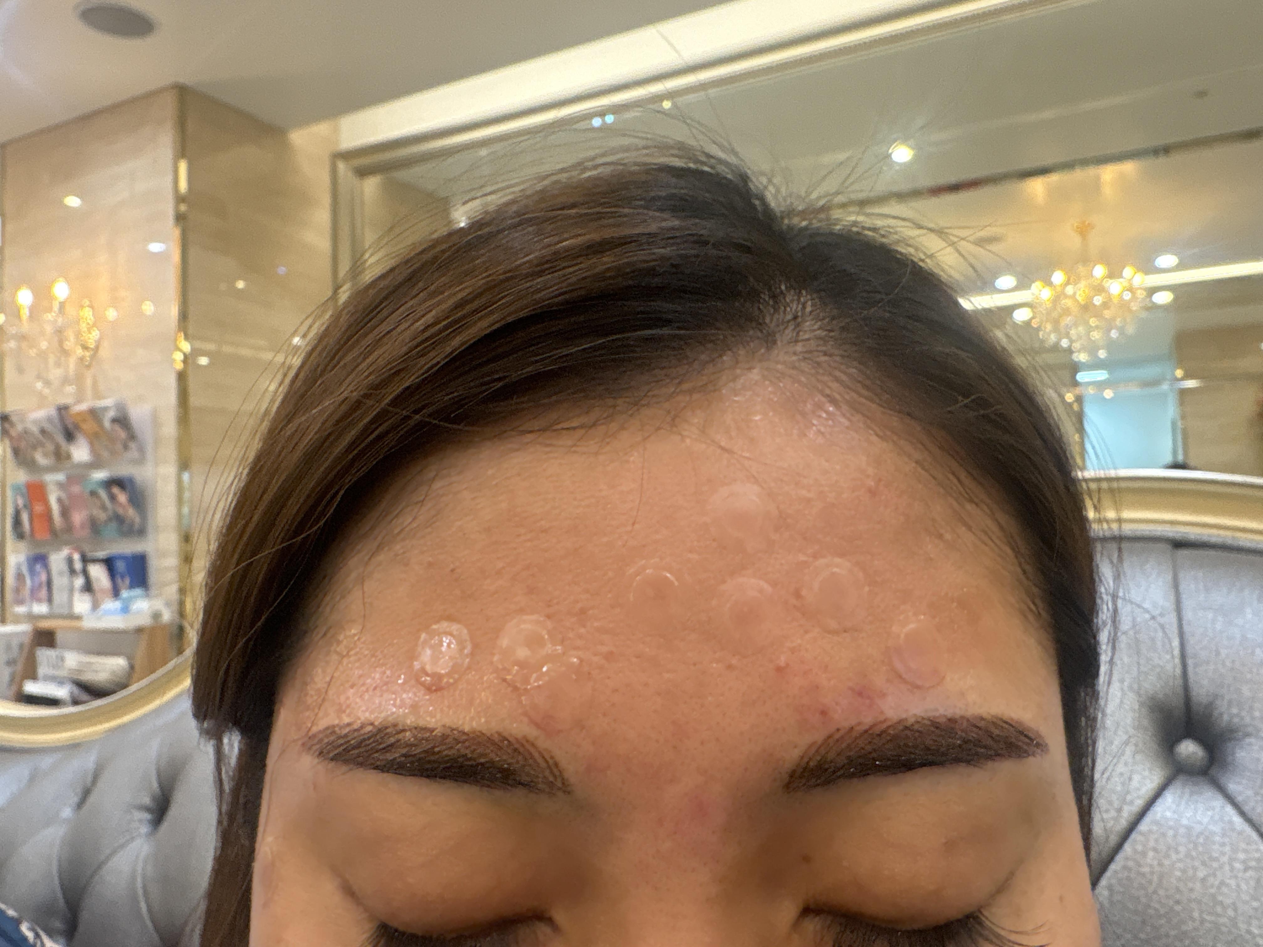 後