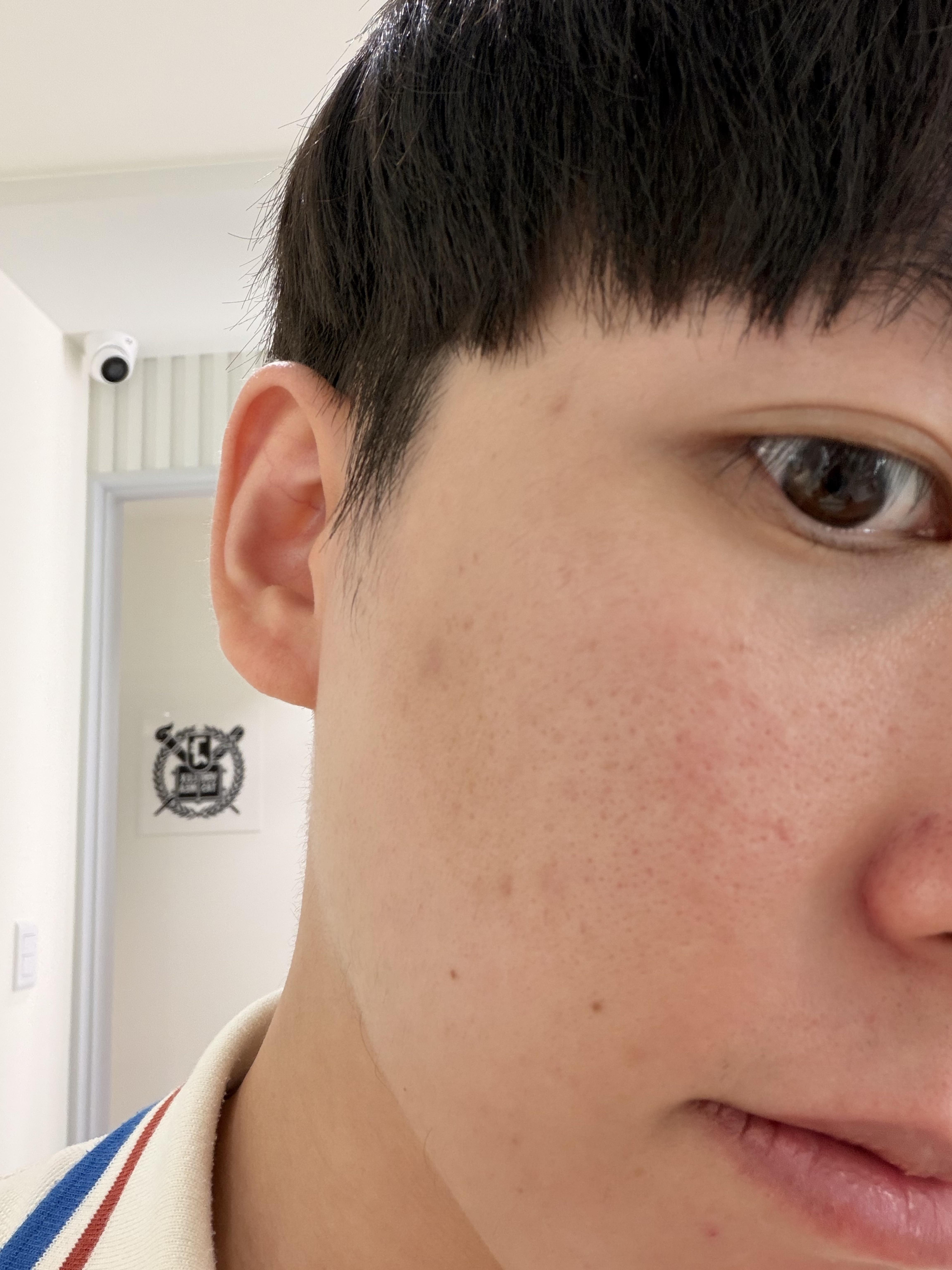 后