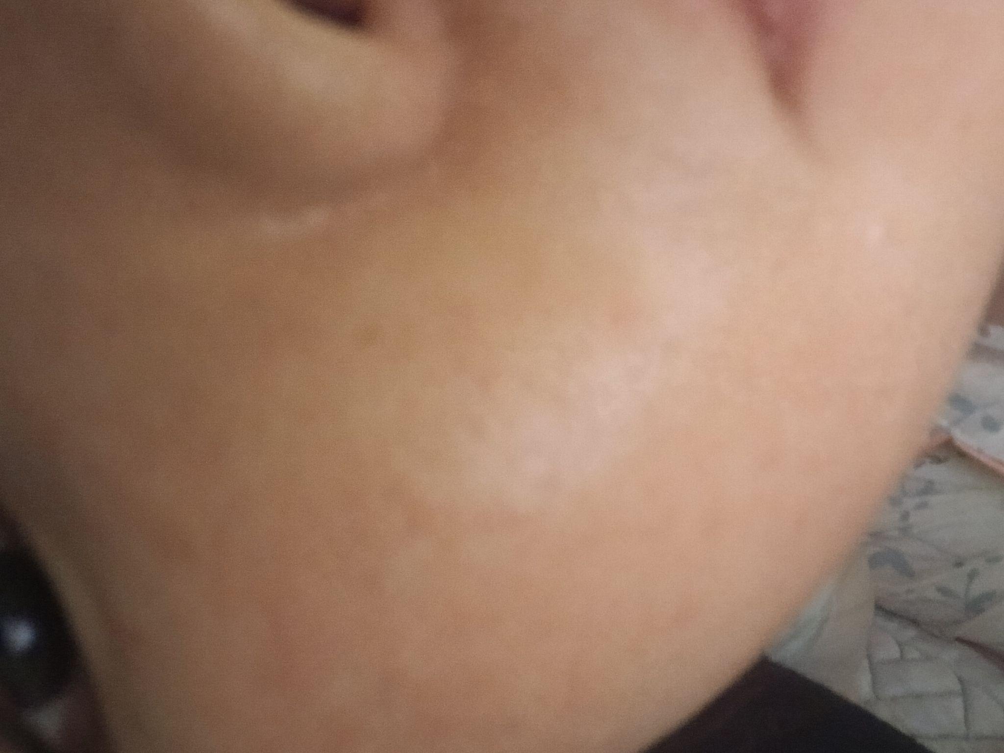 后