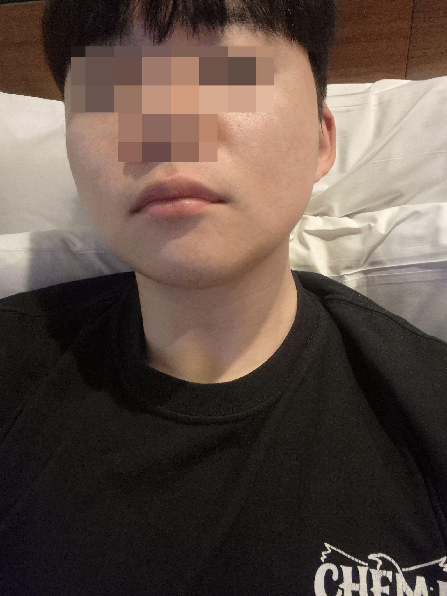 後