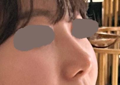 後