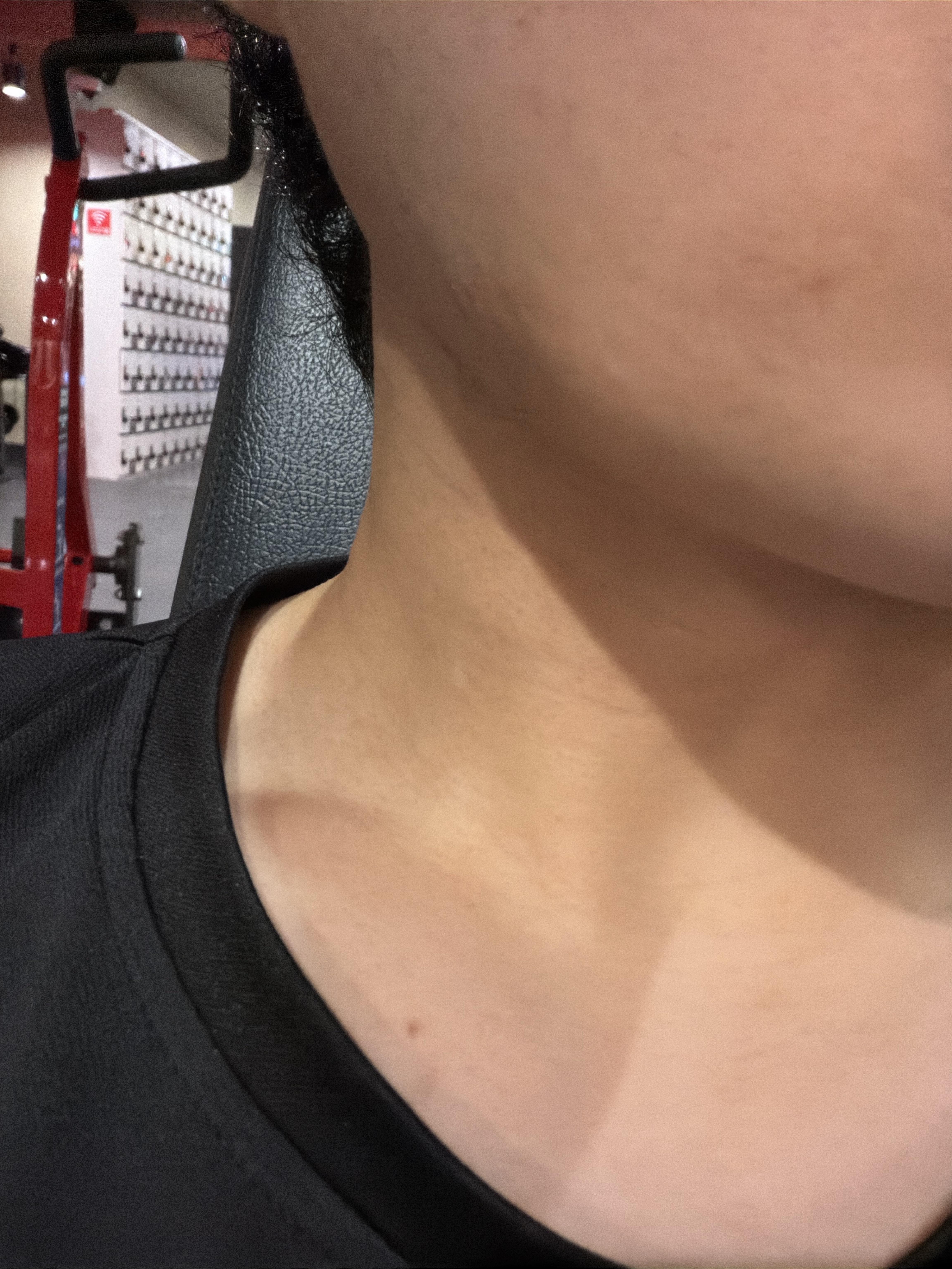 后