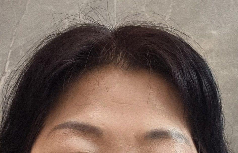 前