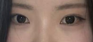 後