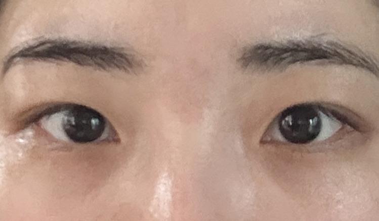 後