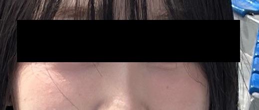 後