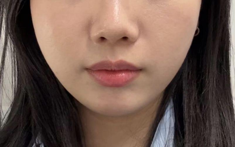後