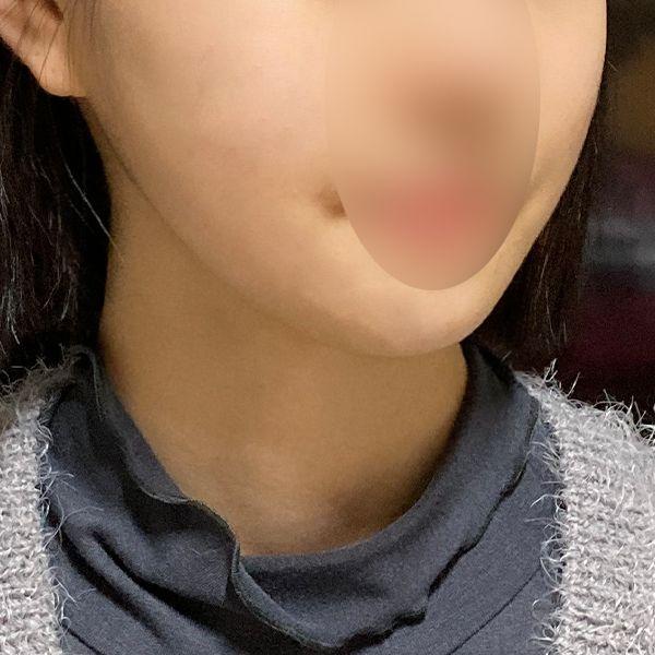 後