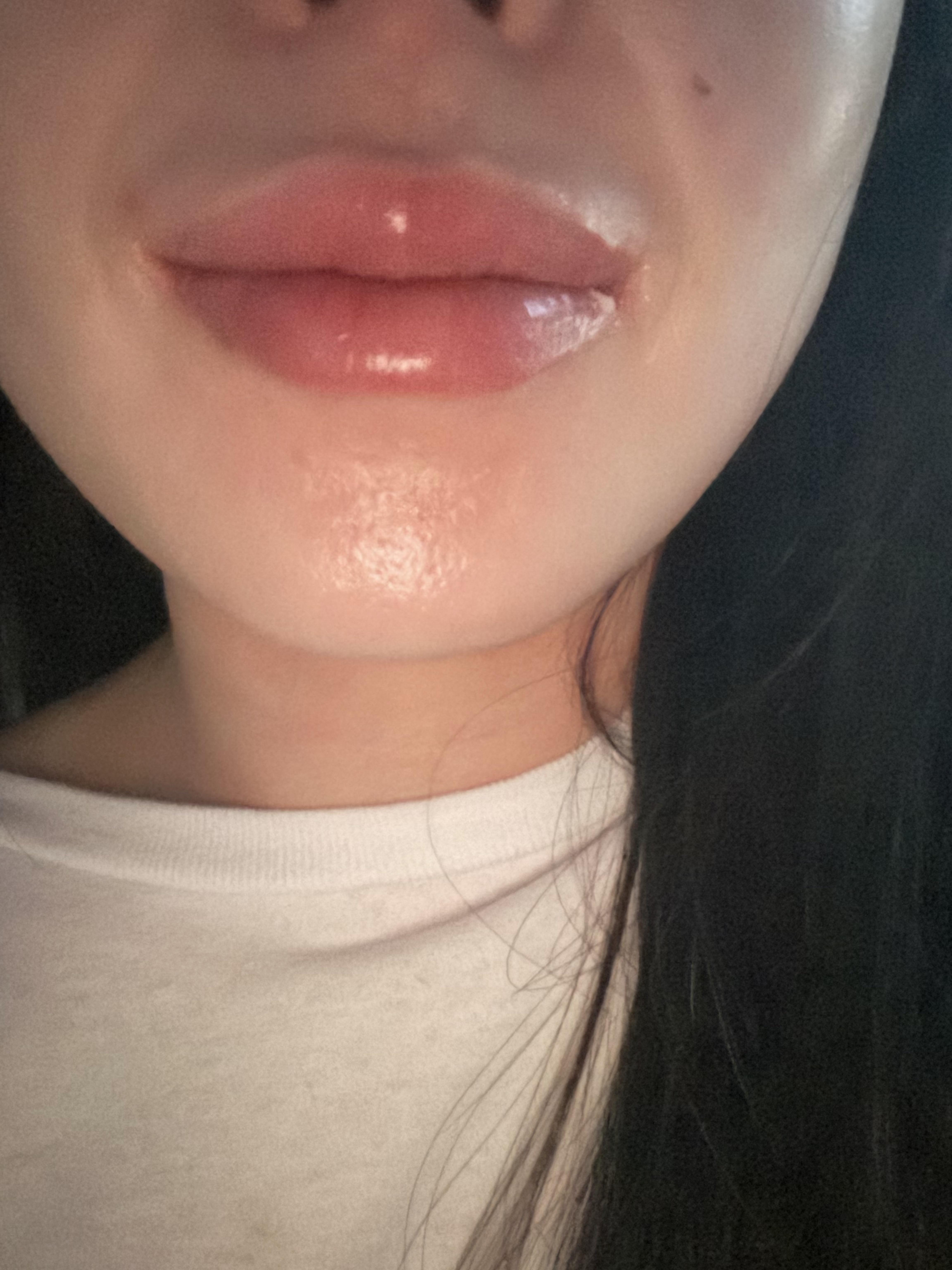 後
