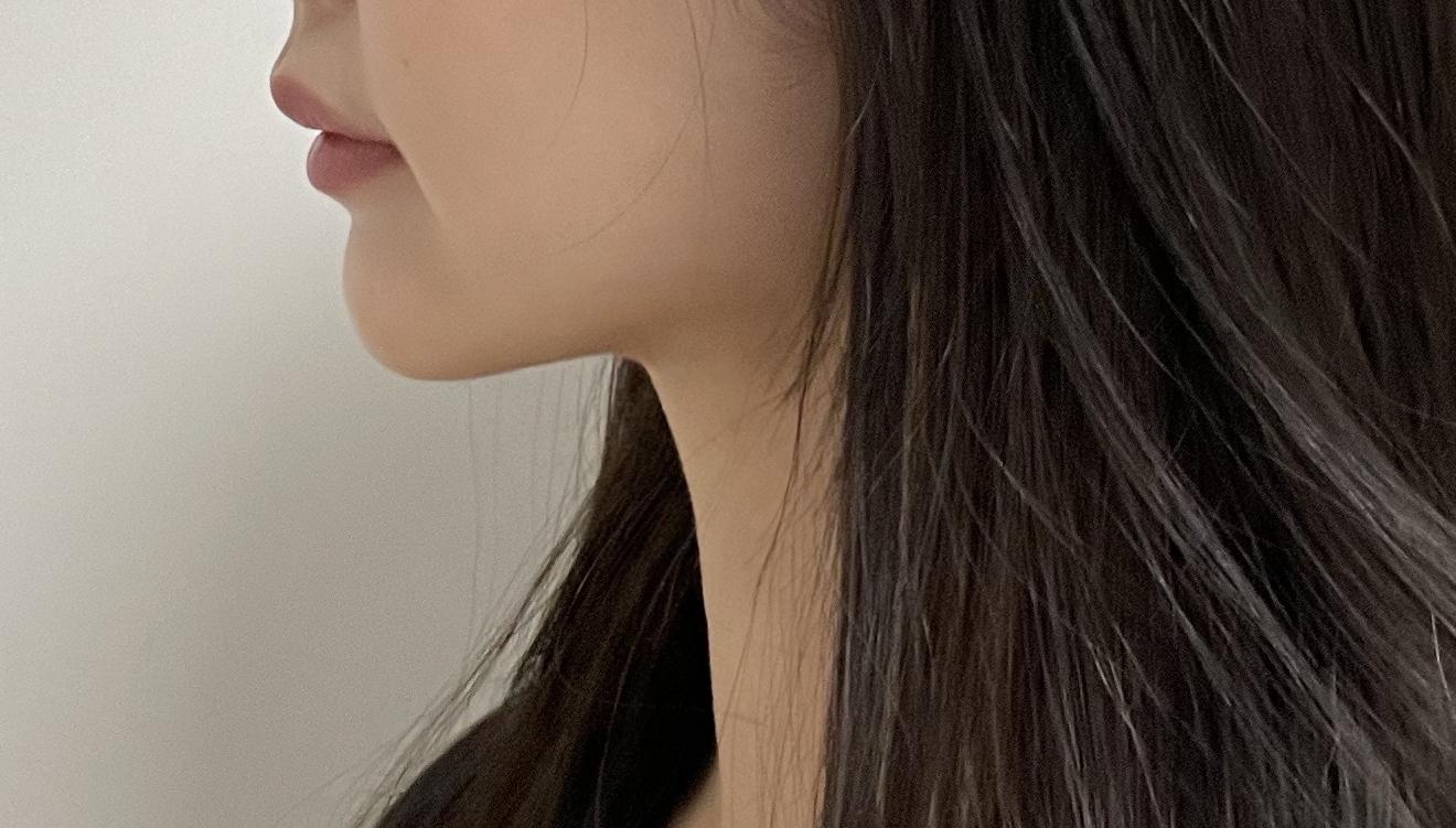 後