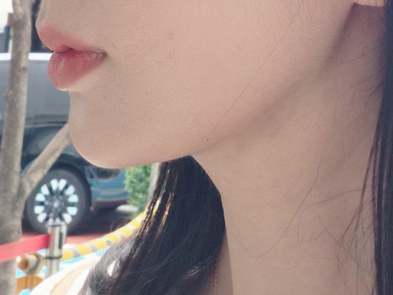 後