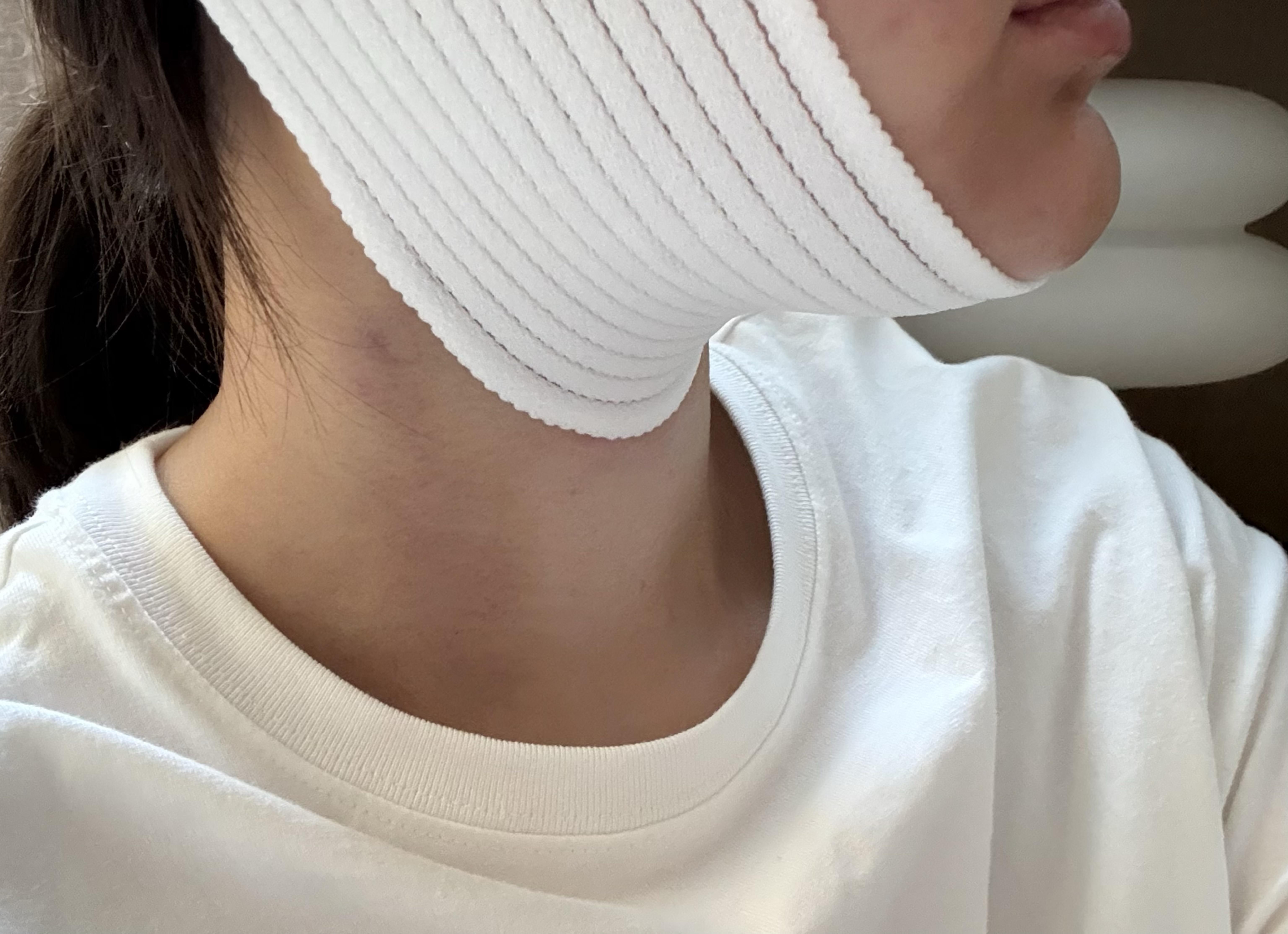 後