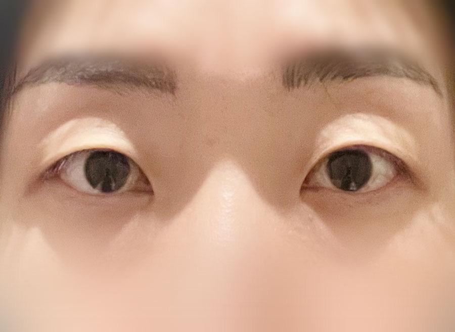 後
