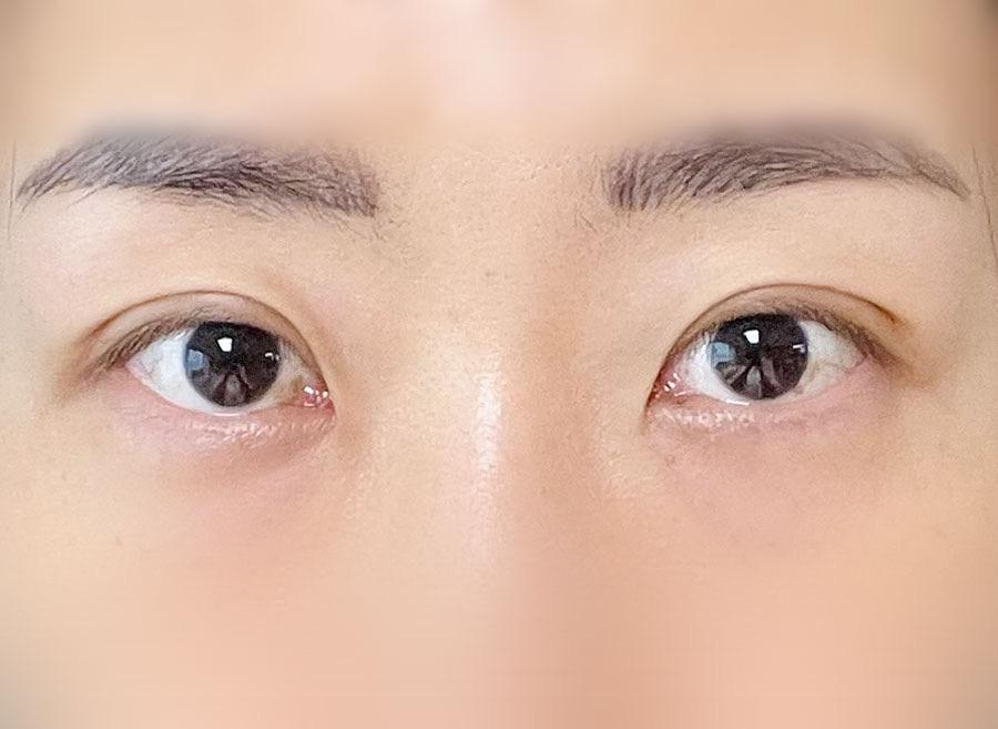 後