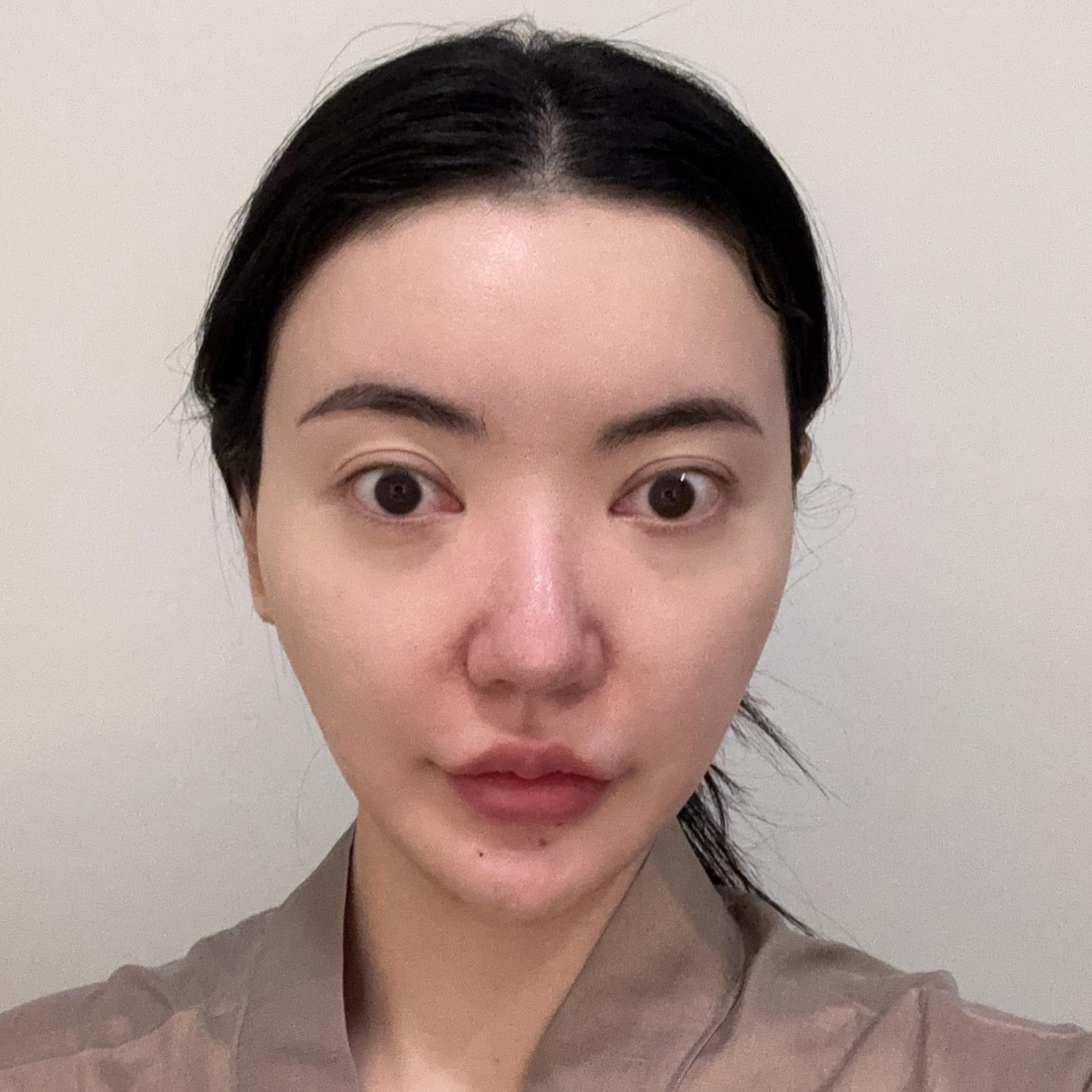 後