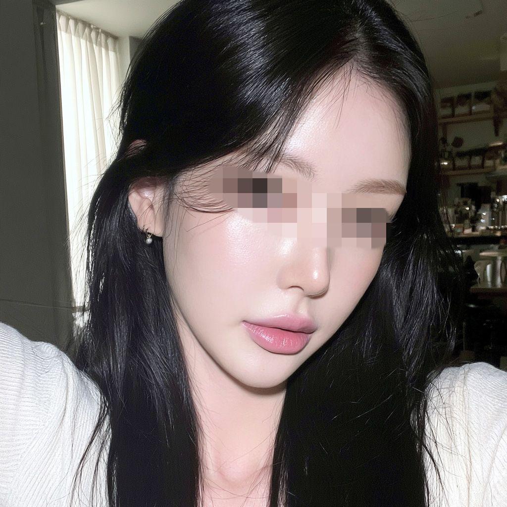 後