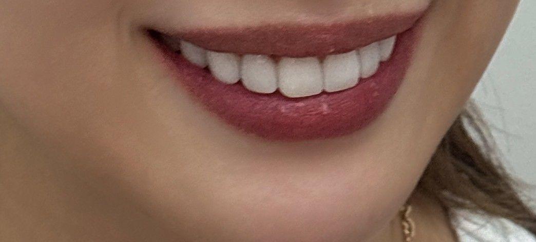 後