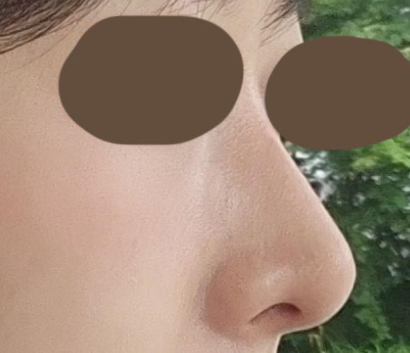 後