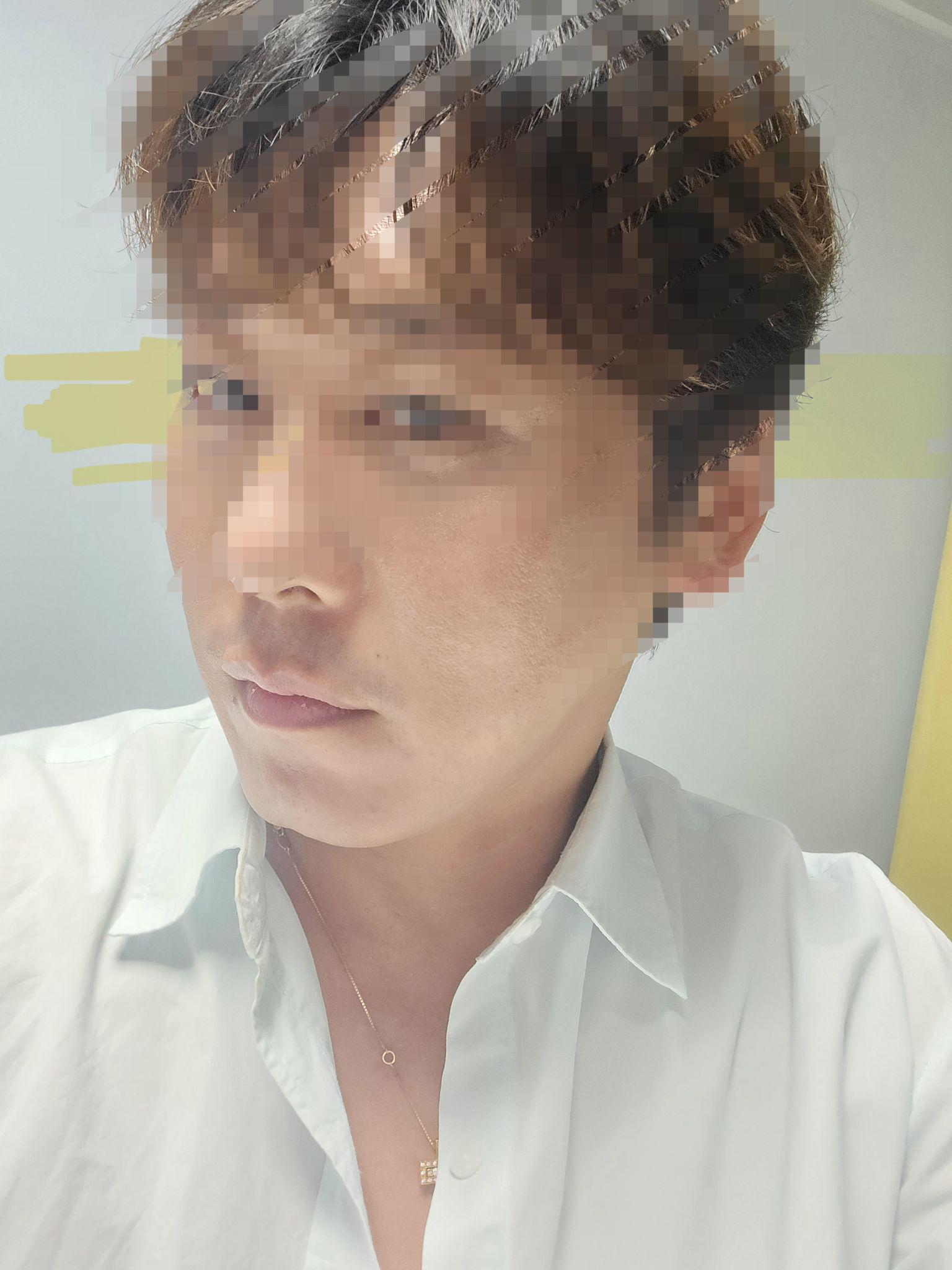 後