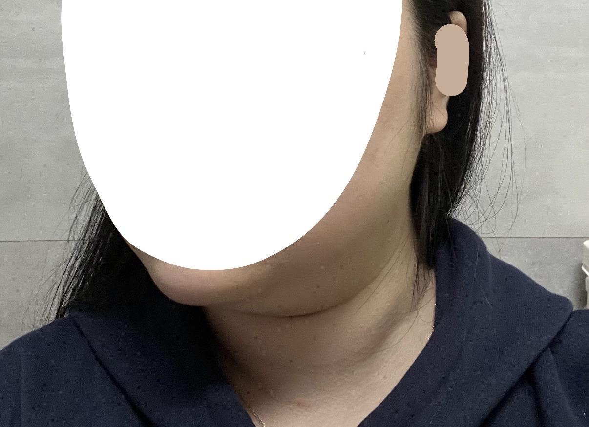 後