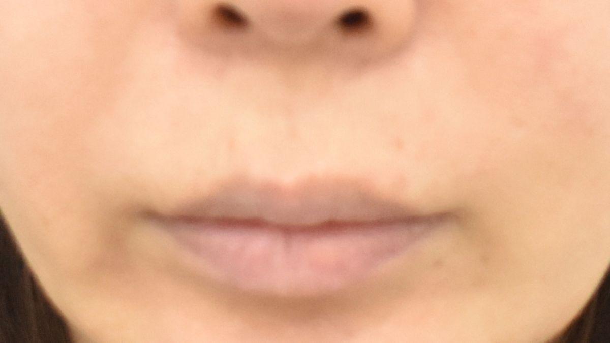 後