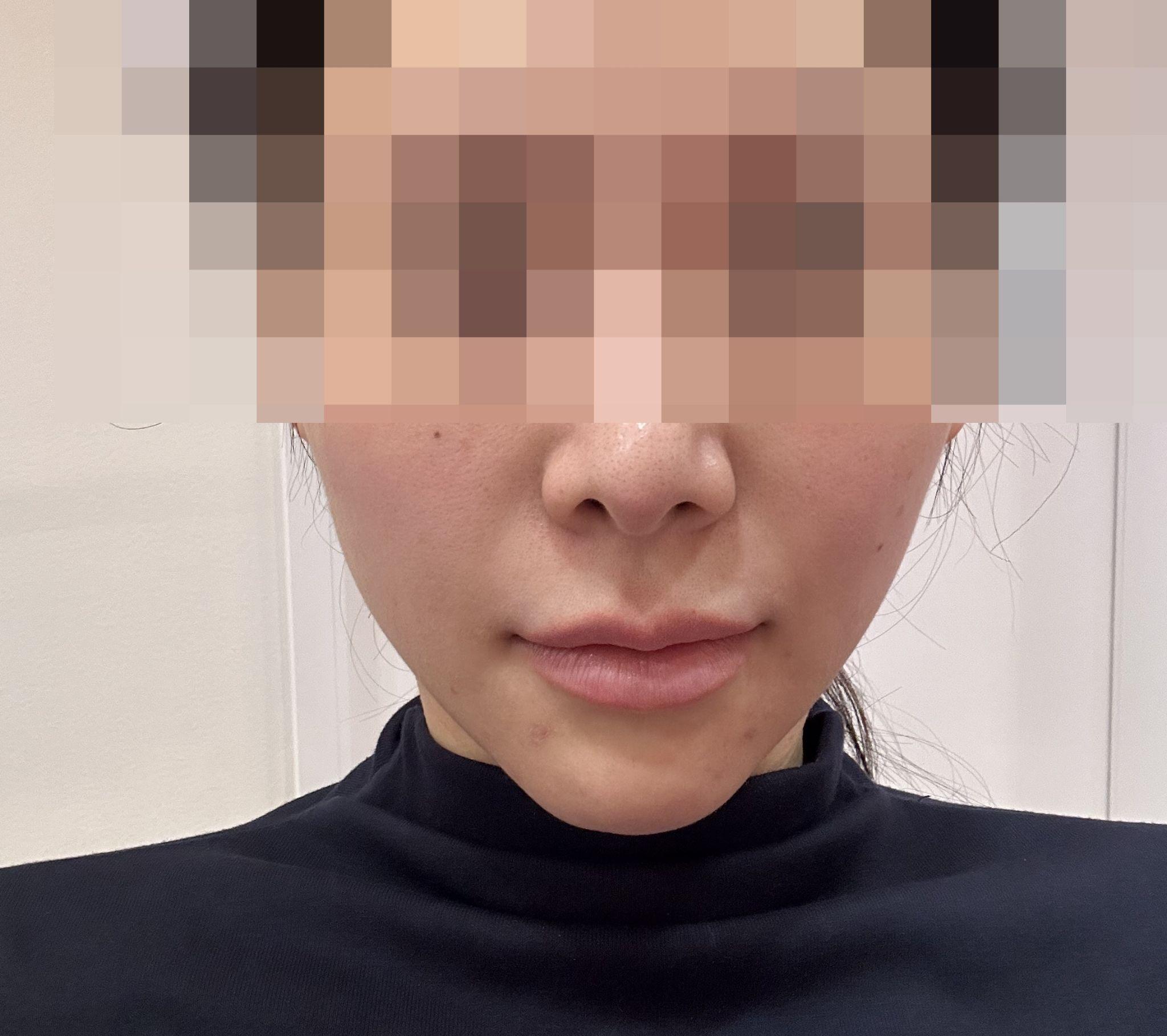 後