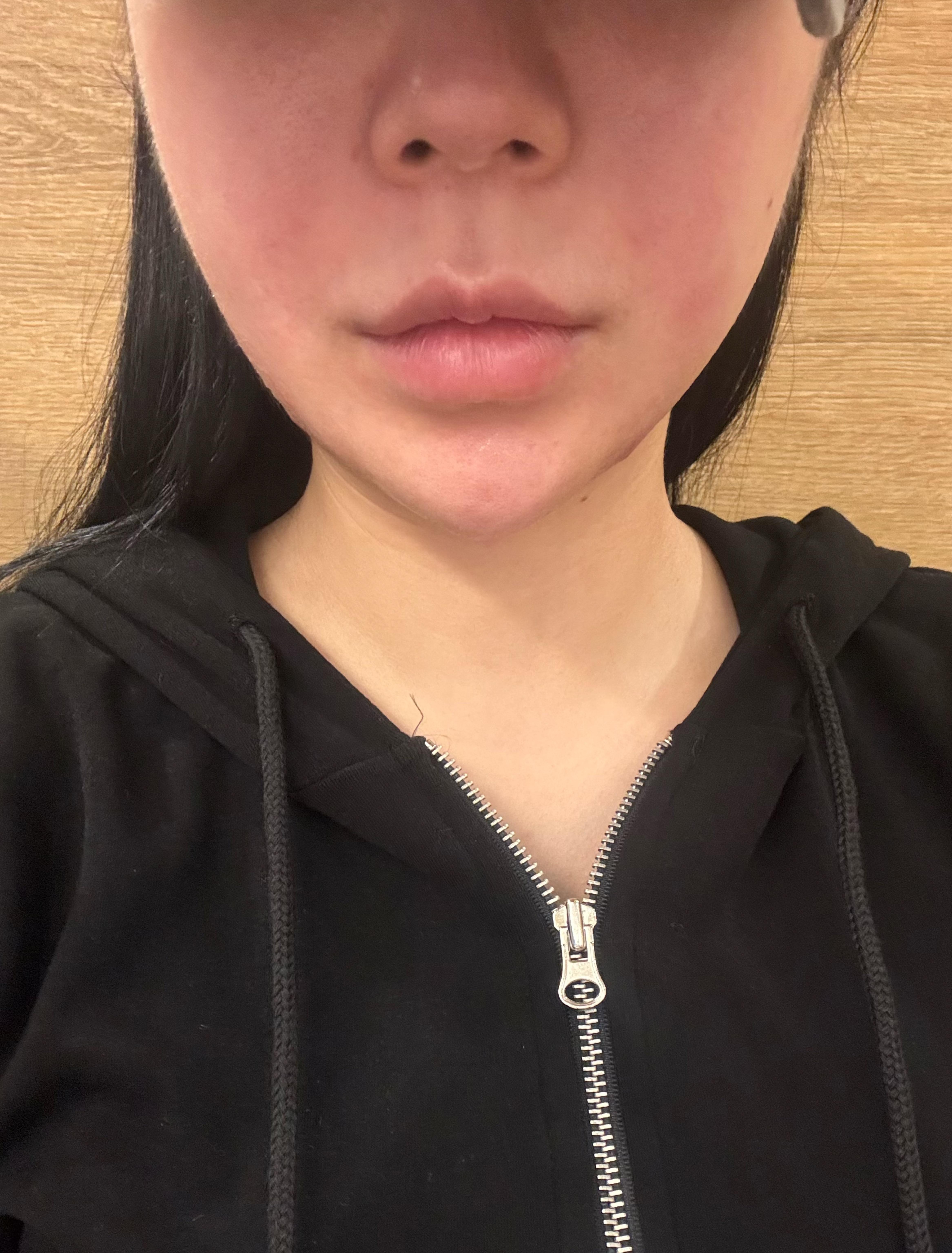 後