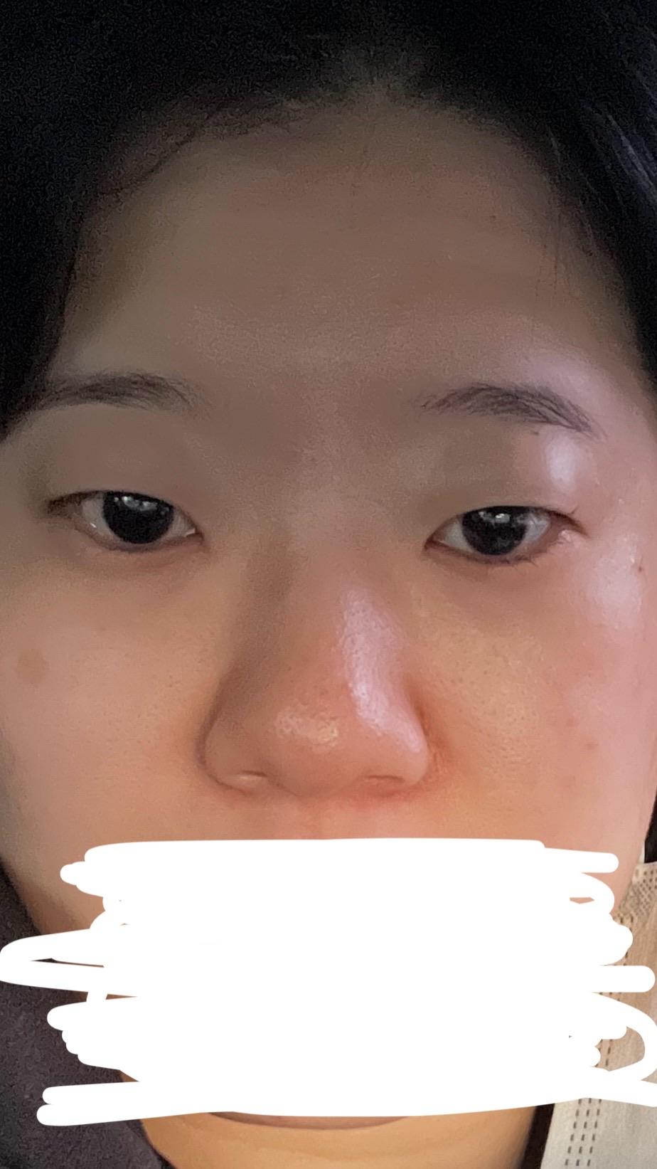 後