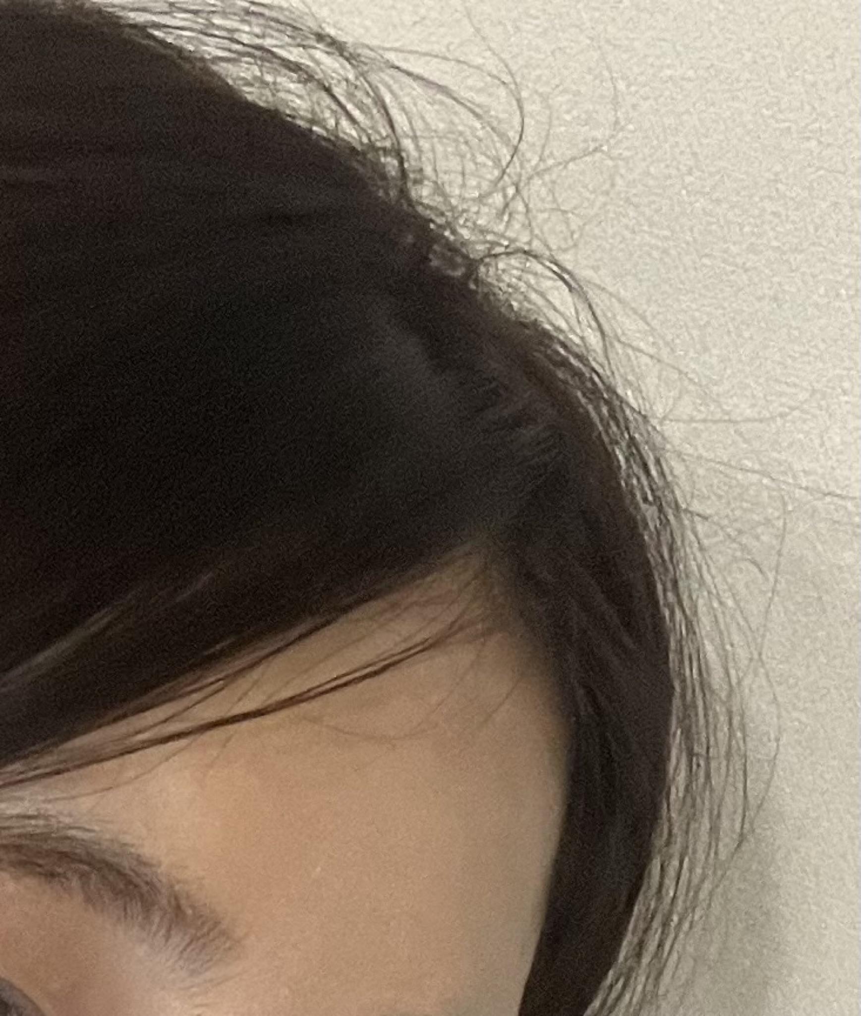 後