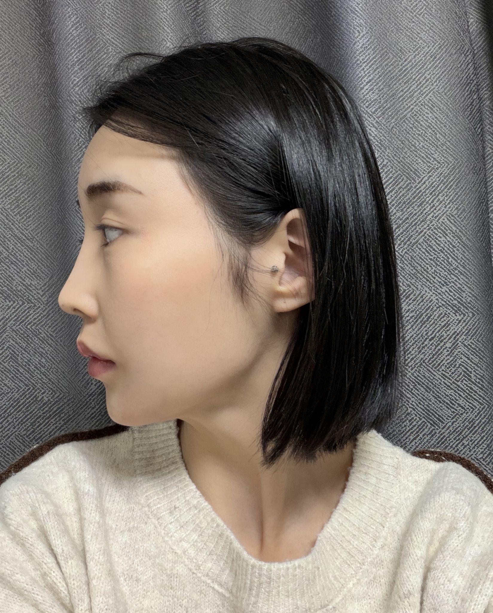 後
