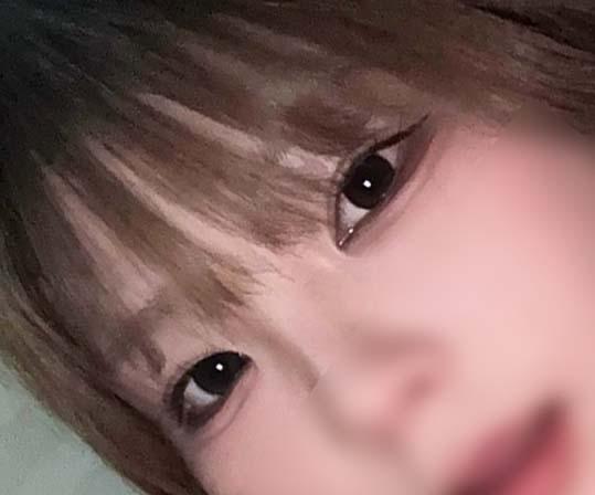 後