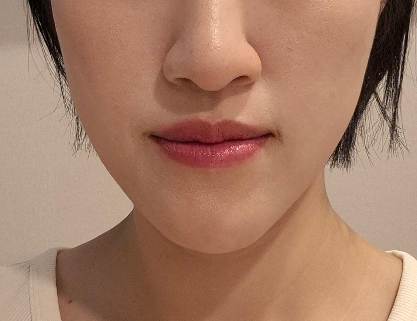 后