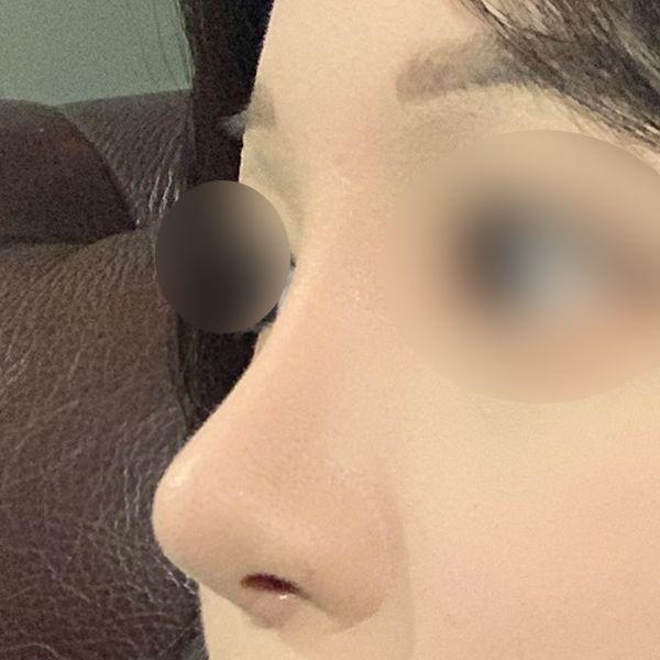 后