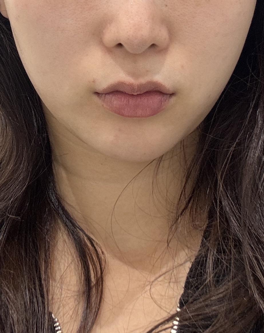 後
